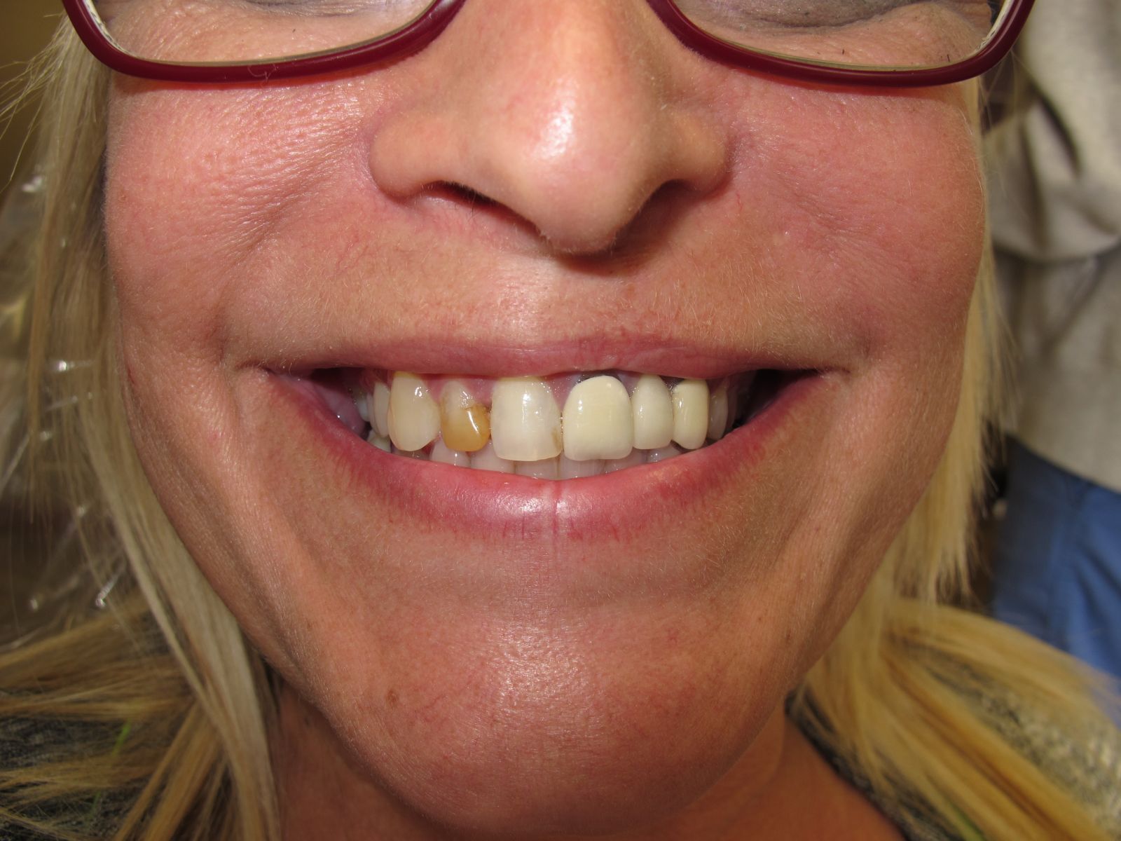 Cosmetic Dentistry Harrisonville, MO Custom Dental of Harrisonville